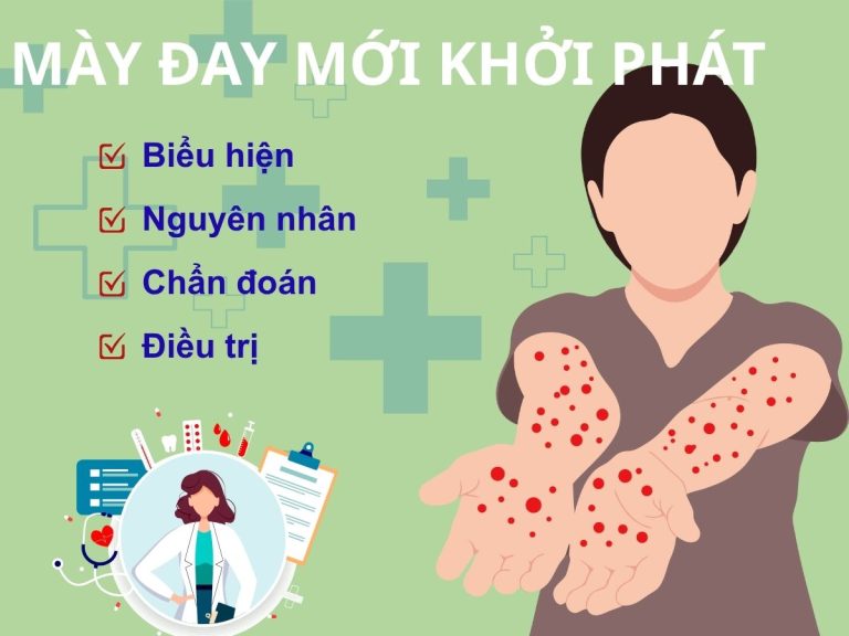 Mày đay mới khởi phát