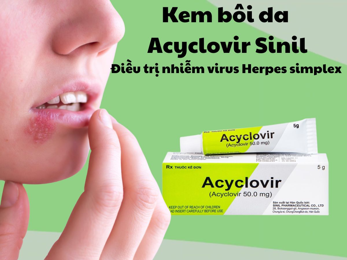 Kem bôi da Acyclovir Sinil 11 Kem bôi da Acyclovir Sinil giúp điều trị herpes simplex môi và sinh dục