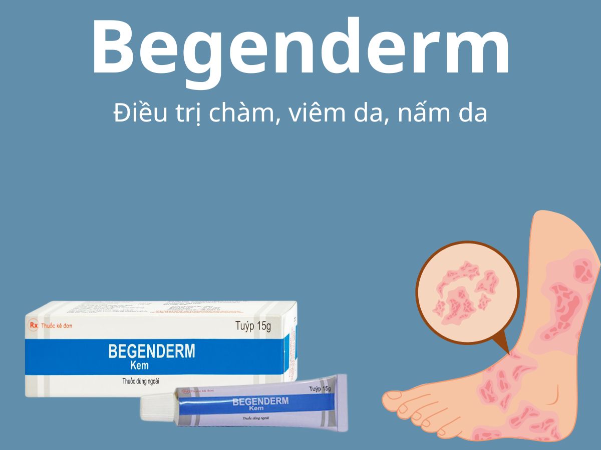 Begenderm