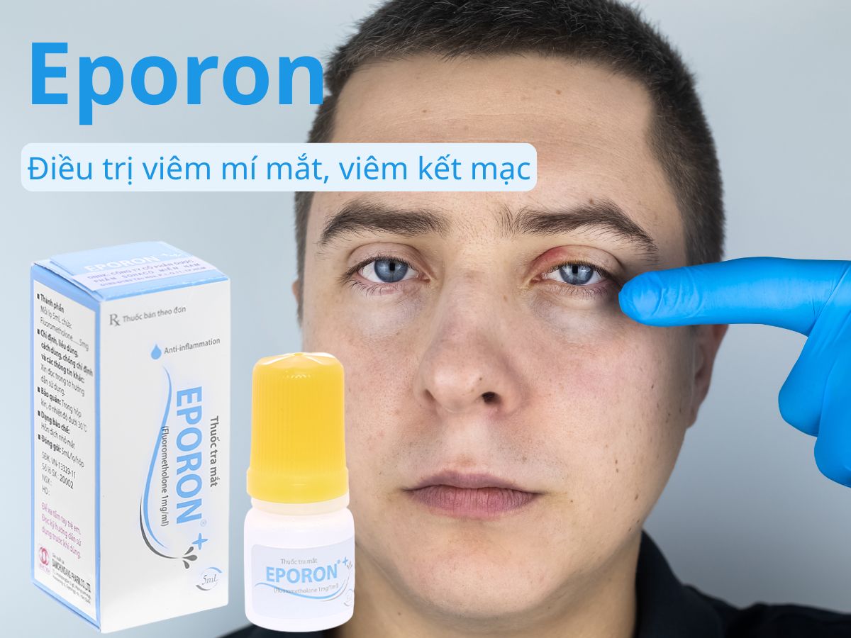 Eporon
