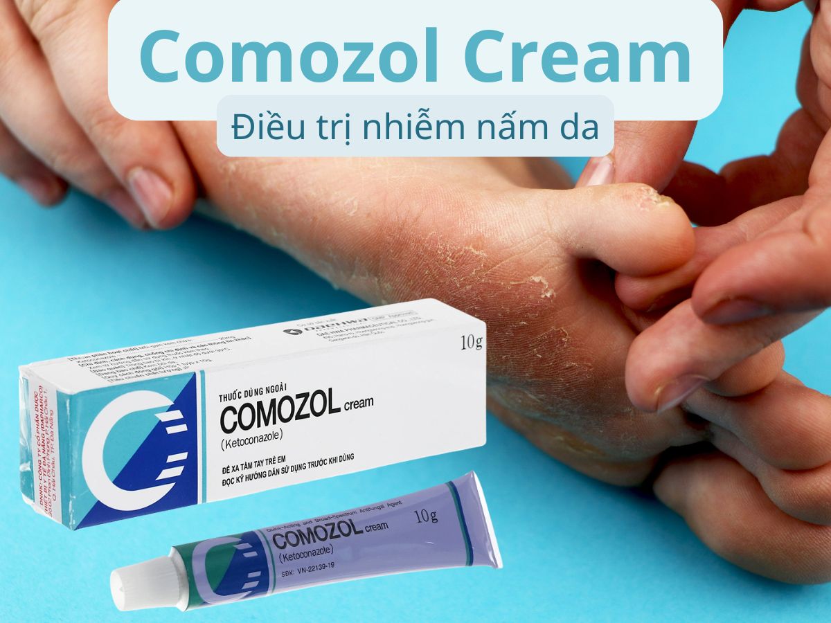 Comozol Cream 12 Comozol Cream