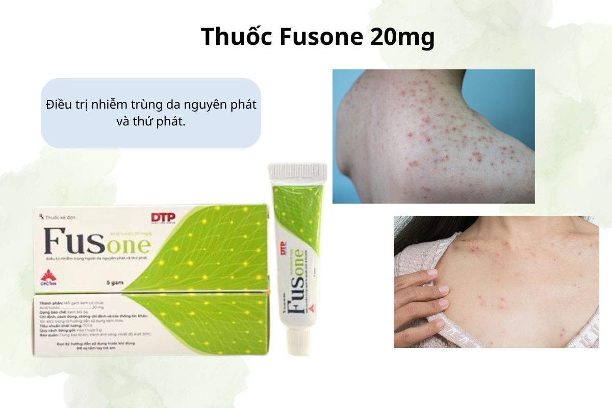 fusone-20mg