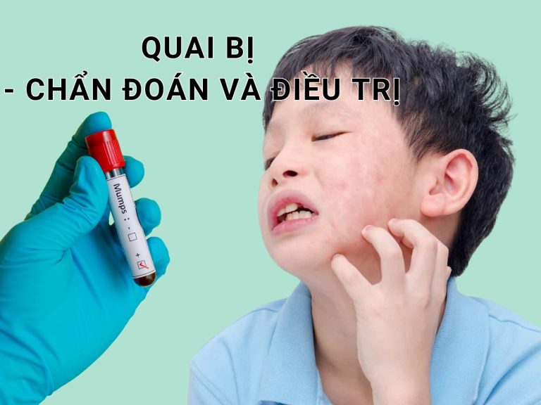 Quai bị - Tổng quan về biểu hiện lâm sàng, điều trị và nguyên tắc phòng bệnh