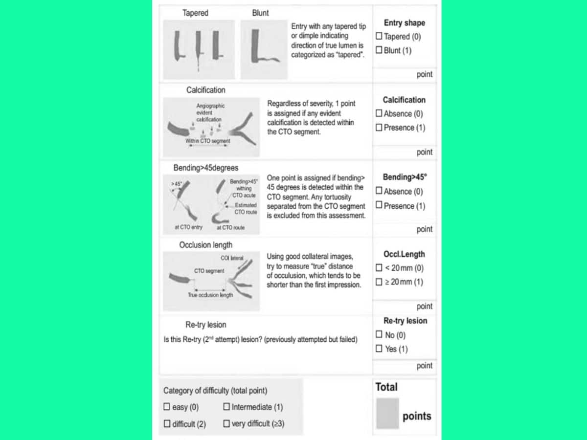 Hình 1. Thang điểm J-CTO để dự đoán khả năng đi dây dẫn can thiệp qua tổn thương tắc thành công trong vòng 30 phút.
