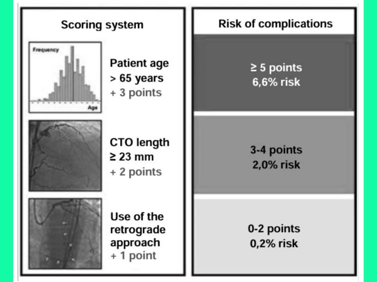Hình 2. Thang điểm biến chứng PROGRESS-CTO để dự đoán nguy cơ biến chứng quanh thủ thuật khi PСІ СТО.