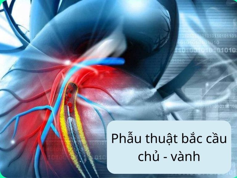 phau-thuat-bac-cau-chu-vanh-3