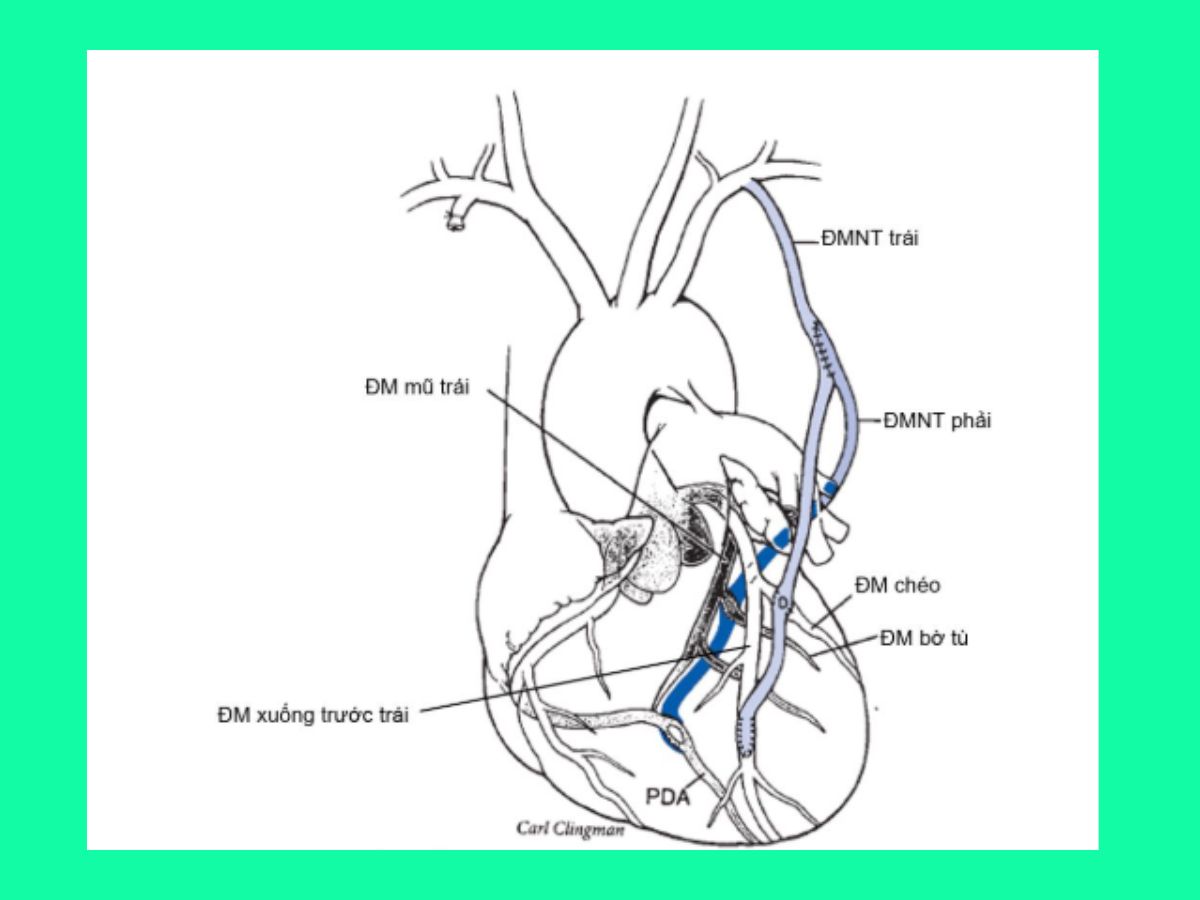 phau-thuat-bac-cau-chu-vanh