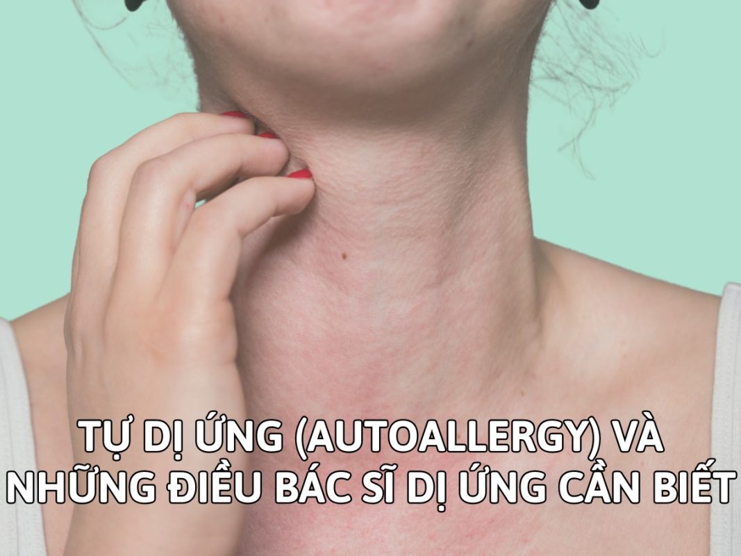 TỰ DỊ ỨNG (AUTOALLERGY) VÀ NHỮNG ĐIỀU BÁC SĨ DỊ ỨNG CẦN BIẾT 2 TỰ DỊ ỨNG (AUTOALLERGY) VÀ NHỮNG ĐIỀU BÁC SĨ DỊ ỨNG CẦN BIẾT