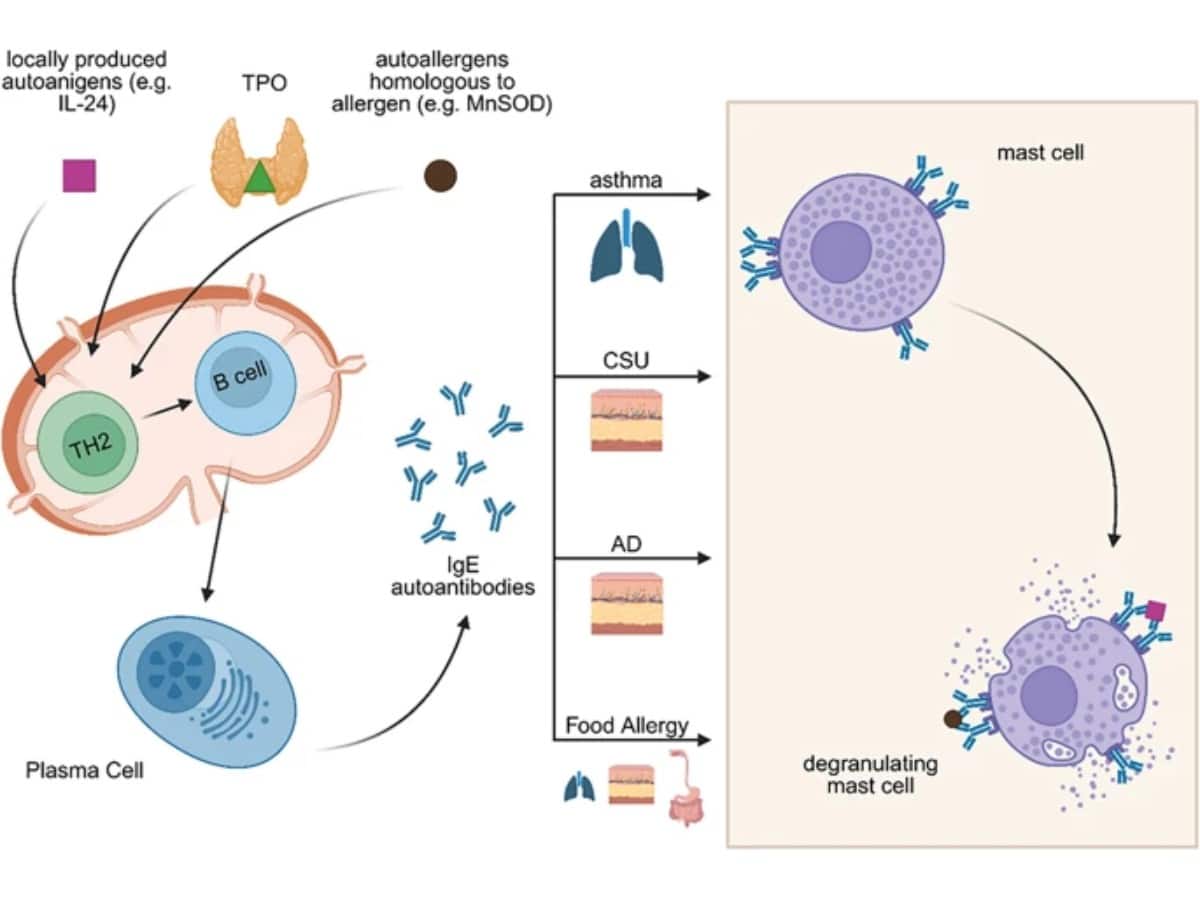 TỰ DỊ ỨNG (AUTOALLERGY) VÀ NHỮNG ĐIỀU BÁC SĨ DỊ ỨNG CẦN BIẾT