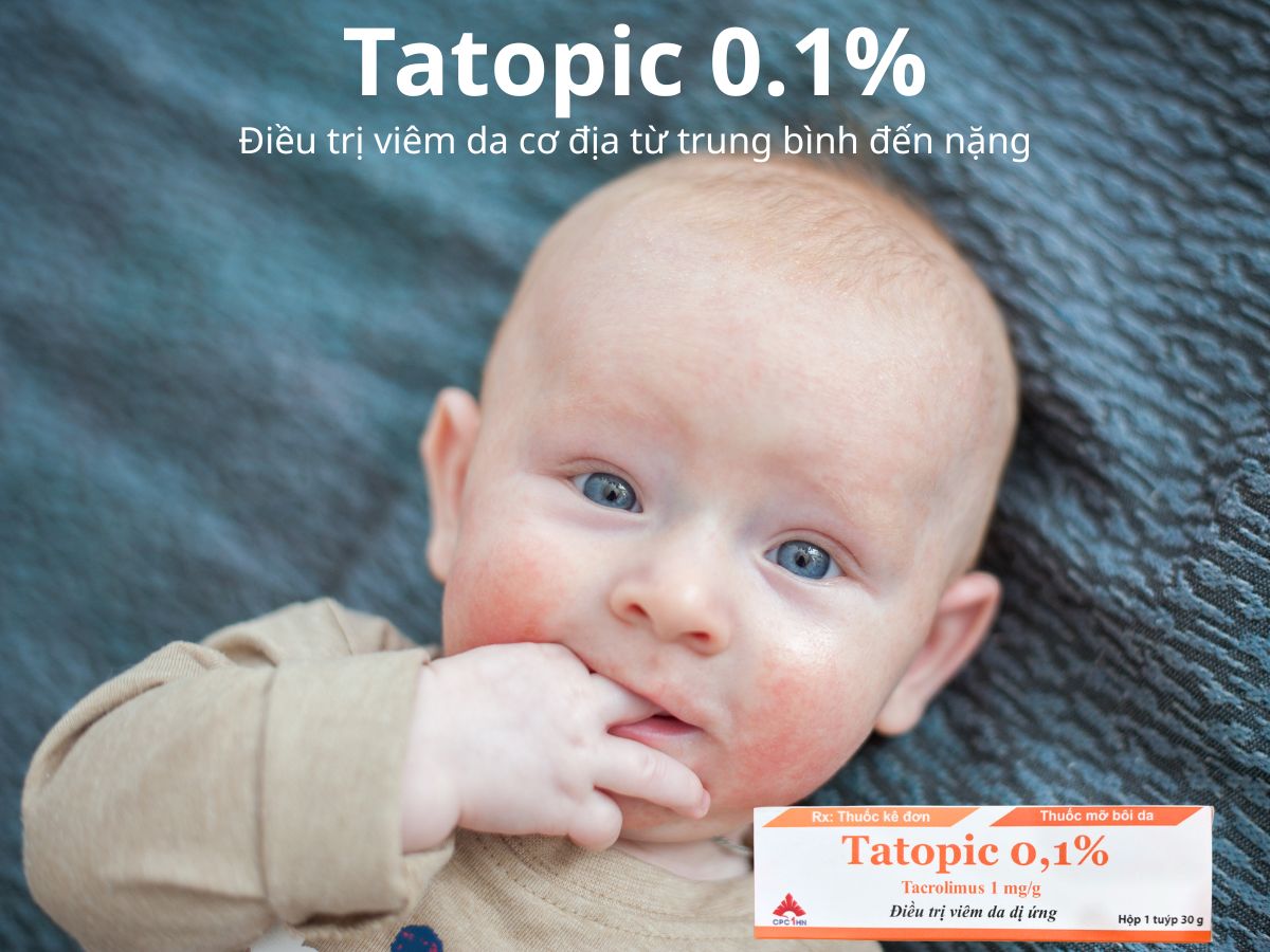 Tatopic 0.1%