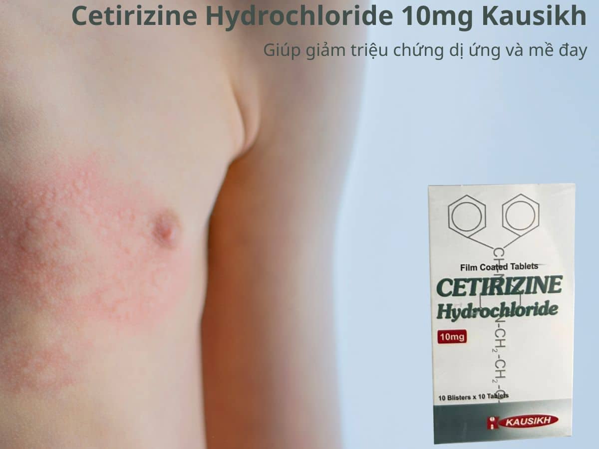 Cetirizine Hydrochloride 10mg Kausikh