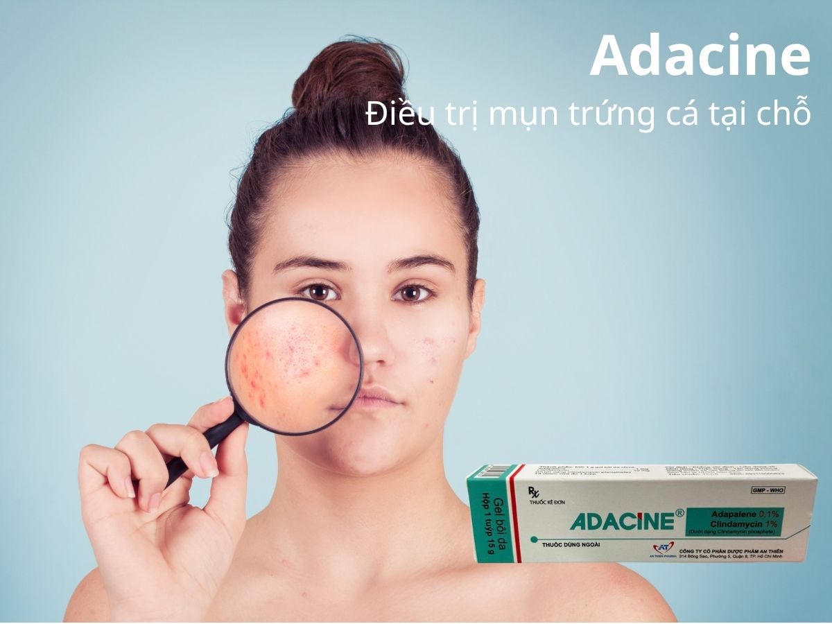 Adacine 9 Adacine