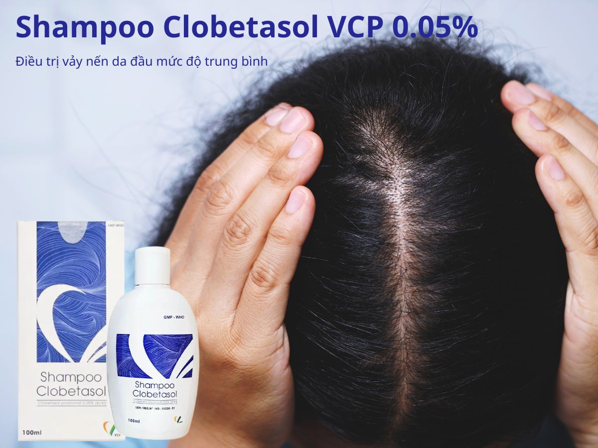 Shampoo Clobetasol VCP 0.05% 9 Shampoo Clobetasol VCP 0.05%