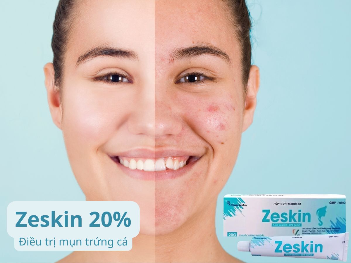 Zeskin 20% 9 Zeskin 20%