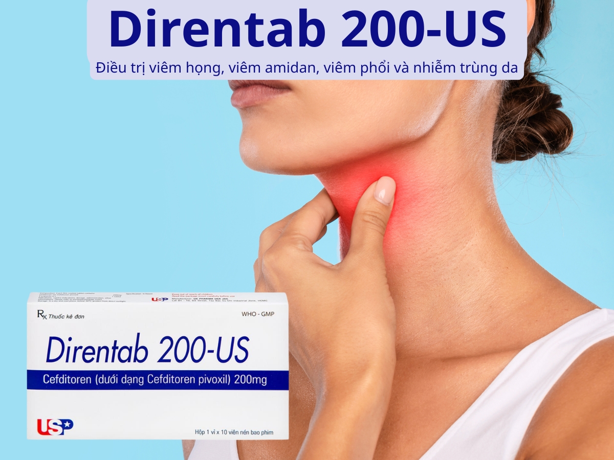 Direntab 200-US 10 Direntab 200-US