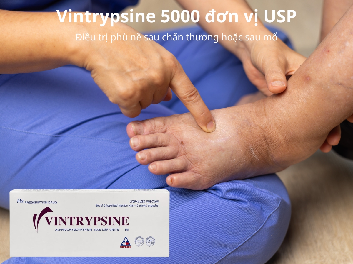 Vintrypsine 5000 đơn vị USP 9 Vintrypsine 5000 đơn vị USP