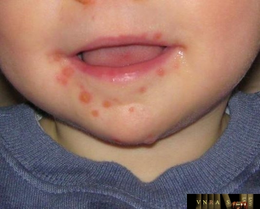 Công văn 1194/KCB-NV