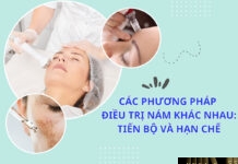 Các phương pháp điều trị nám khác nhau: Tiến bộ và hạn chế