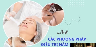 Các phương pháp điều trị nám khác nhau: Tiến bộ và hạn chế