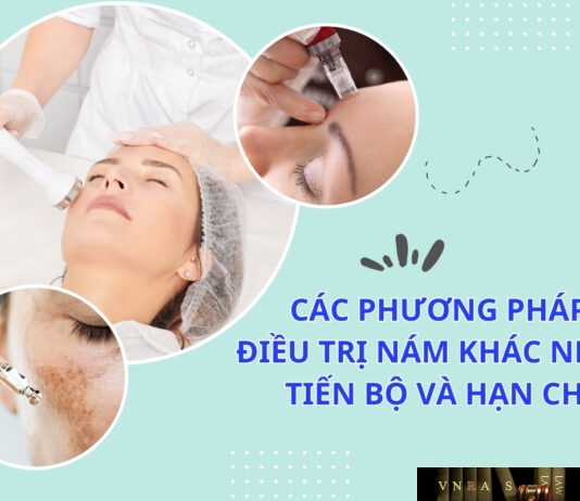 Các phương pháp điều trị nám khác nhau: Tiến bộ và hạn chế