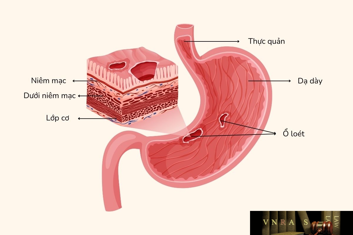 Famotidine